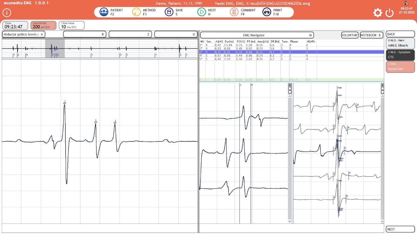 esumedics EMG